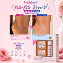 Load image into Gallery viewer, KILI-KILI DUO SET Underarm Whitening & Deodorizing Kit | Dark Underarms, Chicken Skin & Body Odor