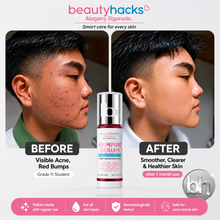 Load image into Gallery viewer, Beauty Hacks VAMPIRE SERUM CONCENTRATE Anti-Aging 1-Step Rejuvenating Brightening Serum 50ml